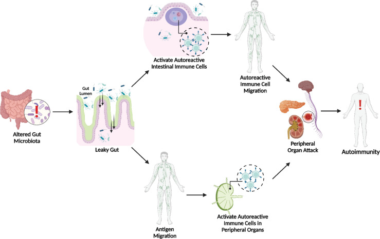 Choroby autoimmunologiczne a jelita