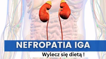 Pokrzywka idiopatyczna leczenie za pomocą dietoterapii.